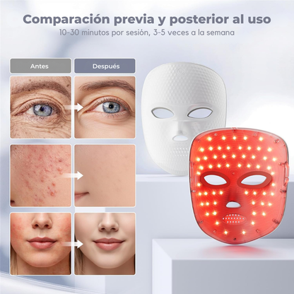 Mascarilla Facial LED de 7 colores, mascarilla Facial de luz roja para rejuvenecimiento