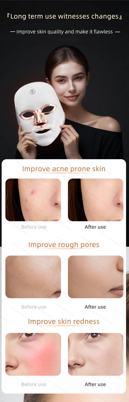 Mascarilla Facial Led de 7 colores con cuello, mascarilla de terapia de luz